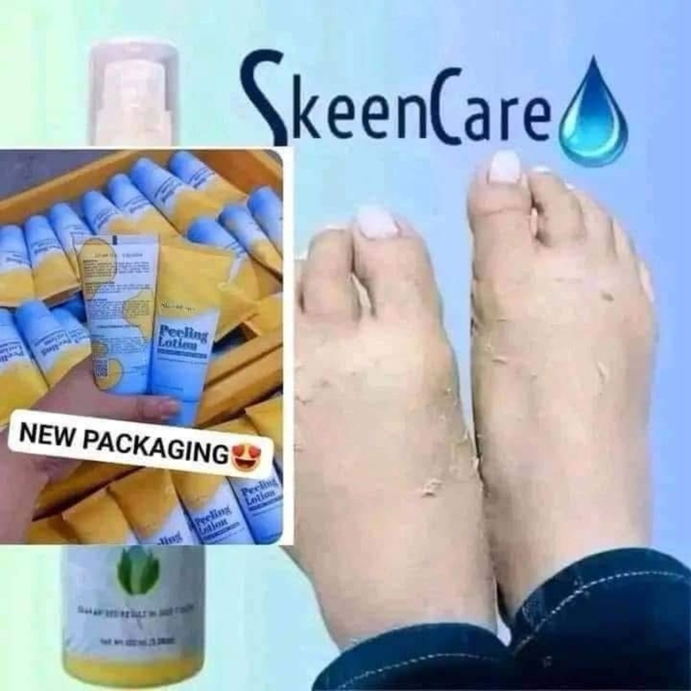 SkeenCare Peeling Lotion - Reveal Smooth, Radiant Skin! ✨ - Picture 5 of 7